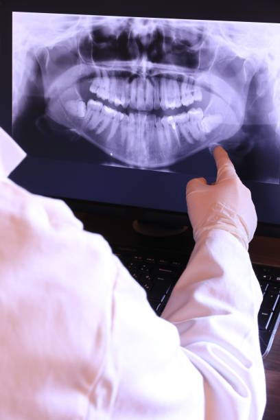 Best Emergency Dental Care for Broken or Chipped Teeth in Marion, IN