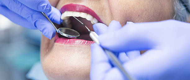 Best Emergency Treatment for Dental Infections or Abscesses in Marion, IN