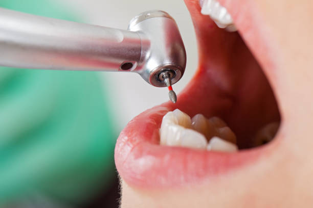 Best Emergency TMJ Treatment in Marion, IN
